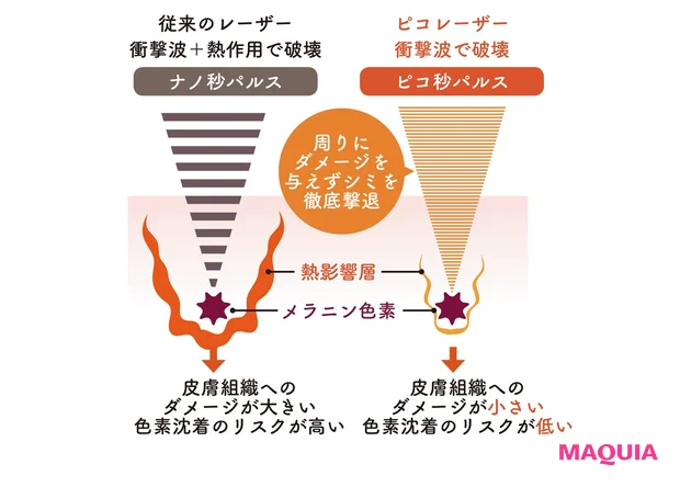 ピコレーザーの仕組み