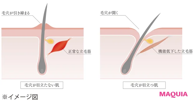 なぜ毛穴が開くのか?