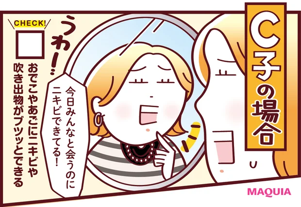 ニキビゆらぎ肌　おでこやあごにニキビや吹き出物がプツッとできる