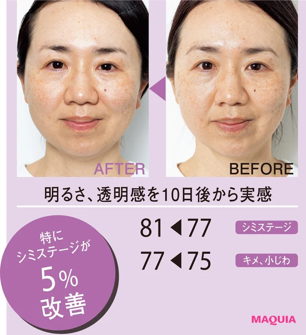 BEFORE/AFTER