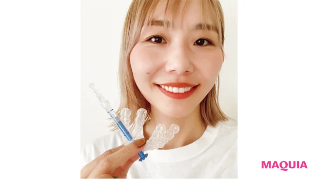 ホームホワイトニング後の森山和子さん
