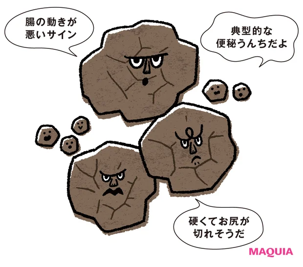 腸活 うんちの状態チェック ガチガチ&コロコロうんち 「腸の動きが悪いサイン」「典型的な便秘うんちだよ」「硬くてお尻が切れそうだ」