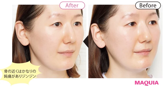 before/after 3