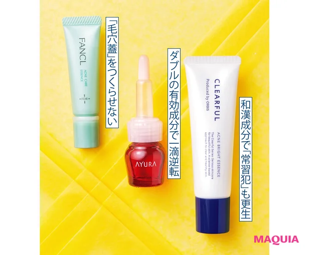 スポッツケアでニキビ・吹き出物を取り調べ