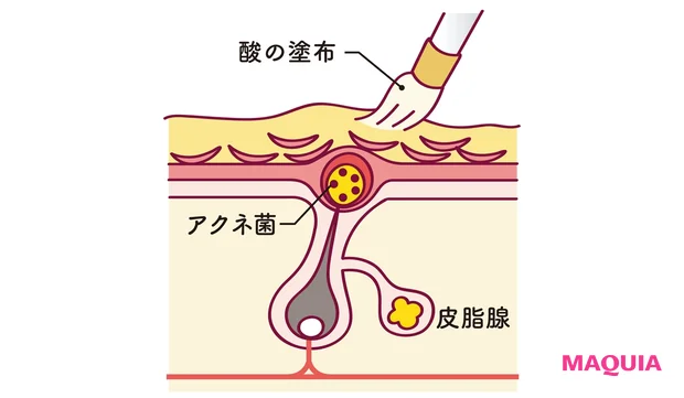 ミルクピールの仕組み