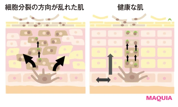 大人のシミの原因は彷徨いメラニンだった!