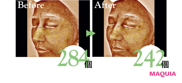 2026年春夏新作 おすすめブライトニングスキンケア SK-II ジェノプティクス アドバンスド スポット エッセンス 表面下シミの個数ビフォーアフター