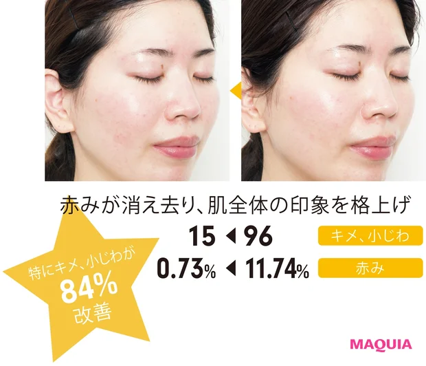 赤みが消え去り、肌全体の印象を格上げ