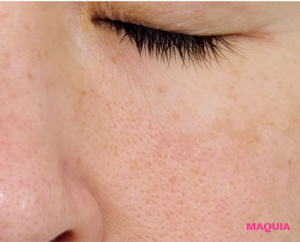 皮脂過多による「開き毛穴」に効くお手入れは？ ビタミンC＆摩擦レスの“攻めないケア”が正解_7_2