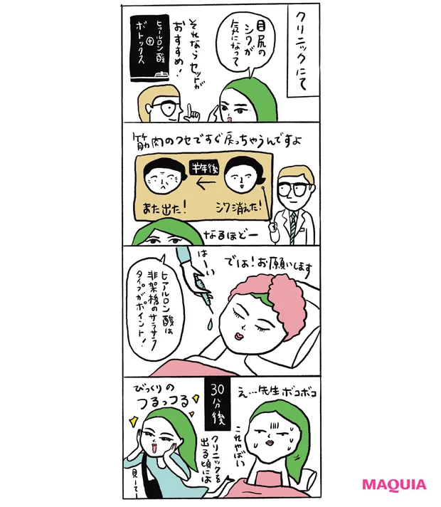 ヒアロ×ボトのシワ治療で 自然にフラットな目元に
