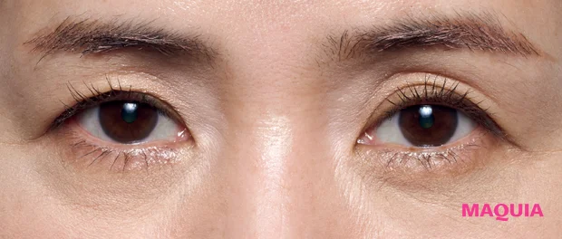 黒ぐま×たるみぐまタイプのくまカバー＆涙袋メイクのテクニック アフター