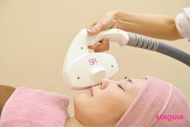 毛細血管赤みにおすすめの美容医療 IPL