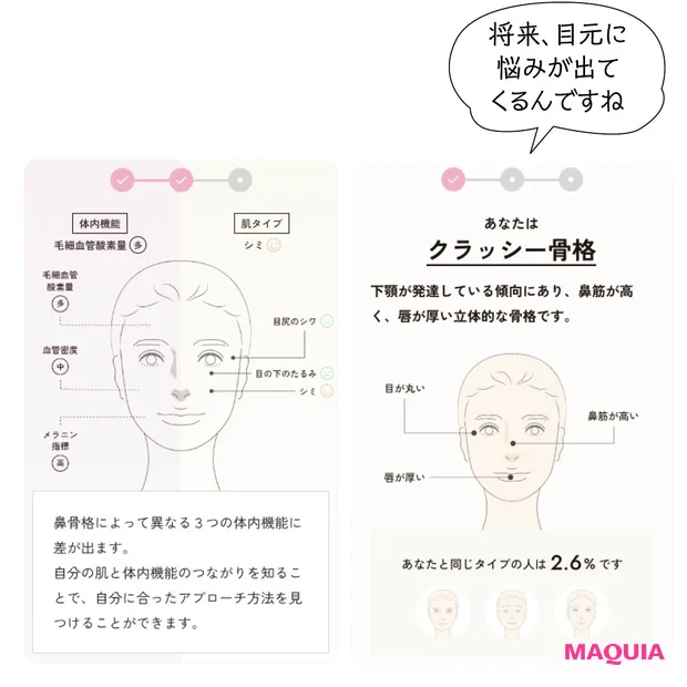 鼻骨格チェック クラッシー骨格タイプ