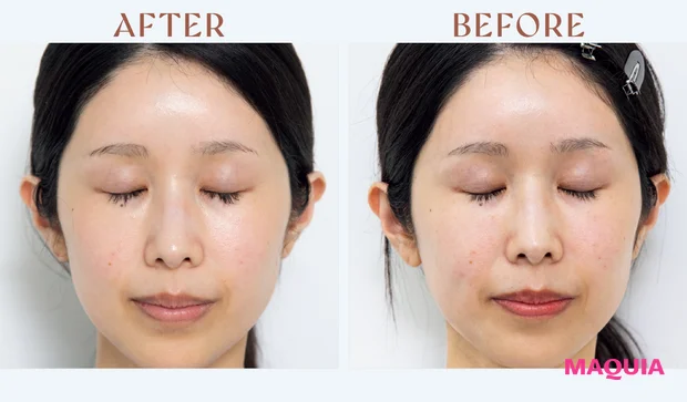 マキア　みんなのベスコス 2025年 上半期　ルルルン ハイドラ EX マスク　レビュー