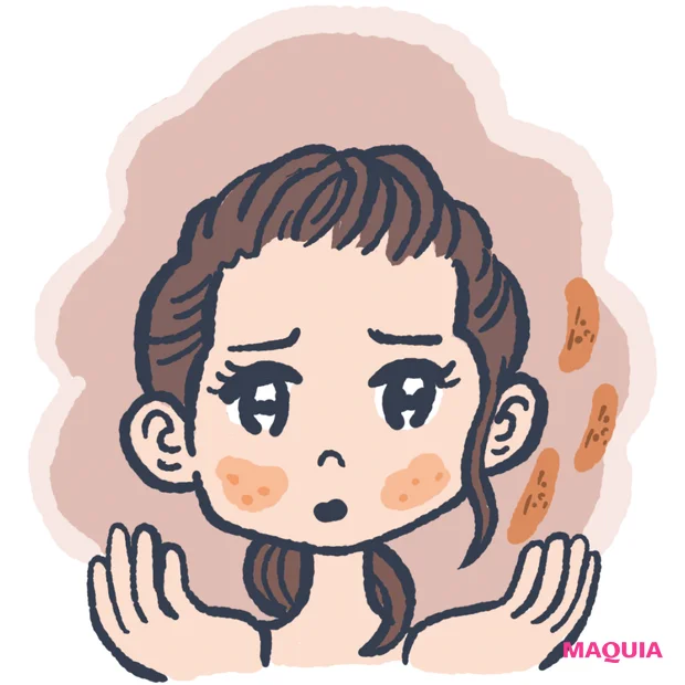 くすみの原因となる肌トラブル 角質溜まり