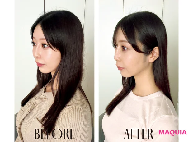 最新おすすめヘアガジェット MYTREX HEAD SPA DEEP Xをお試しレビュー