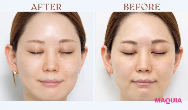 マキア　みんなのベスコス 2025年 上半期　SHISEIDO アルティミューン™ パワライジング セラム　レビュー