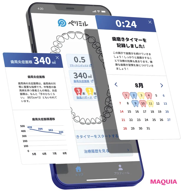 歯周病の事実 アプリ ペリミル