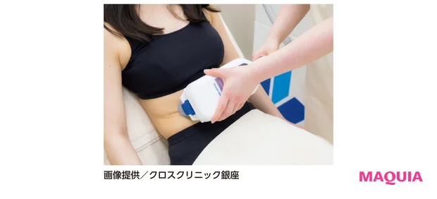 クールスカルプティングの施術シーン