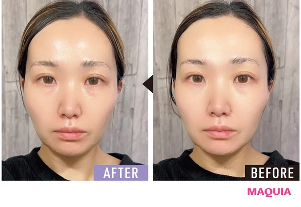 hirokoさんBEFORE/AFTER