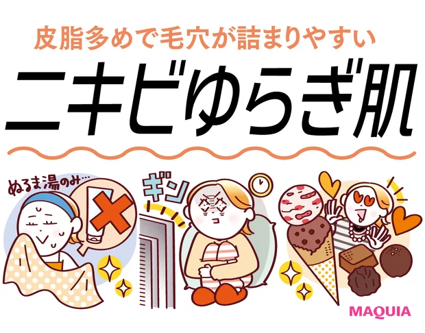 【ニキビゆらぎ肌】糖質の摂りすぎ、睡眠不足が影響！注意点＆おすすめのスキンケアを紹介