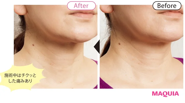before/after 8