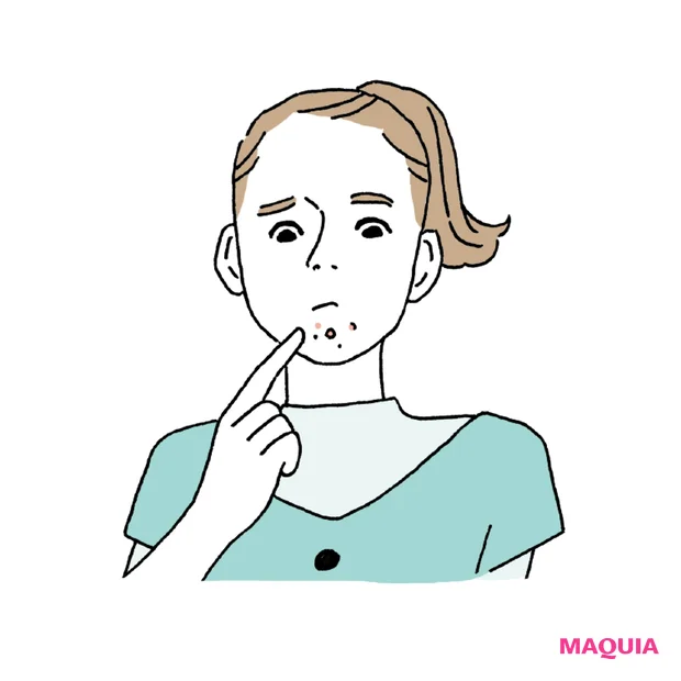 ホルモンバランスが悪いとニキビができやすい