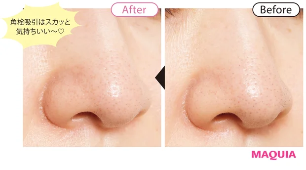 before/after 6