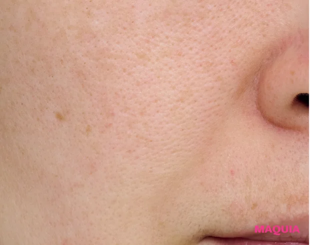 エイジングによる「たるみ毛穴」は、マッサージ&最新コスメでお手入れを。話題の「ジュベルック」体験記も_7_2