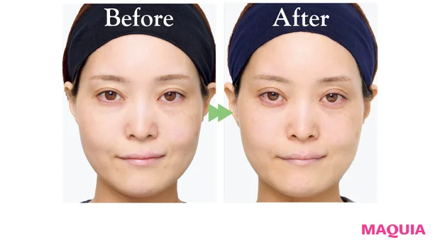 2026年春夏新作 おすすめブライトニングスキンケア FAS ザ ブラック ブライトセラム Ⅱ ビフォーアフター