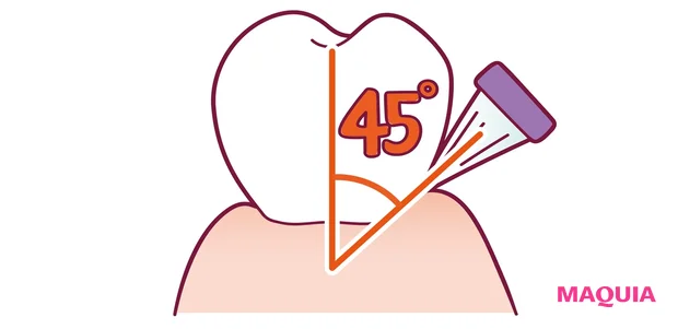 45度でのもじもじ磨きが効果的