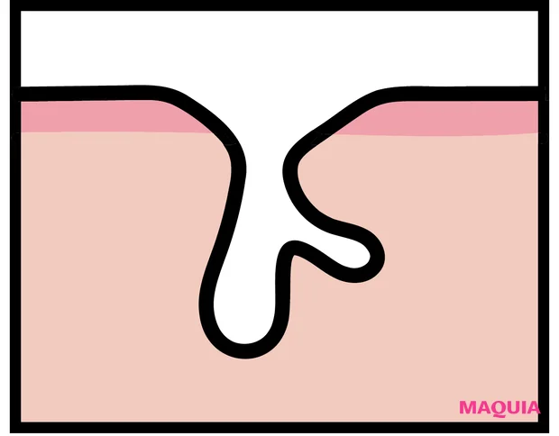 エイジングによる「たるみ毛穴」は、マッサージ&最新コスメでお手入れを。話題の「ジュベルック」体験記も_2