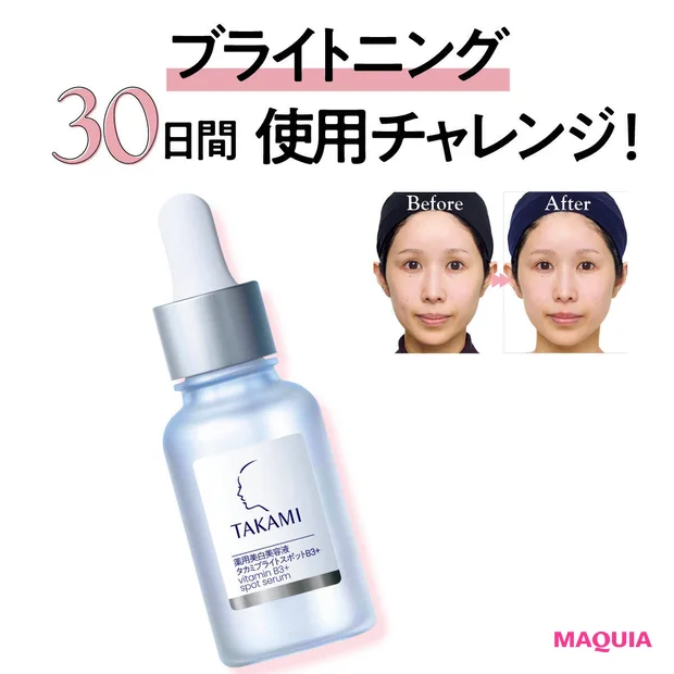 TAKAMIの新作「タカミブライト スポットB3＋」30日使用レビュー！シミの個数の変化を公開