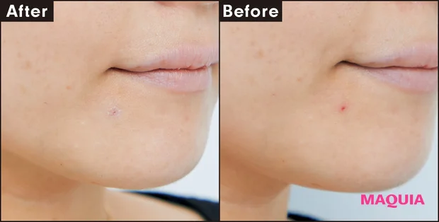 Before After