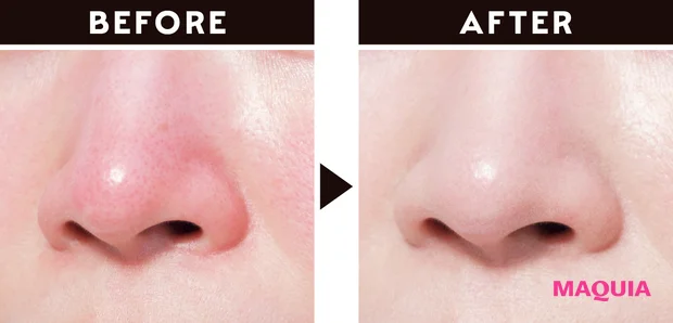 鼻まわりの赤み隠しにおすすめのメイク ビフォーアフター