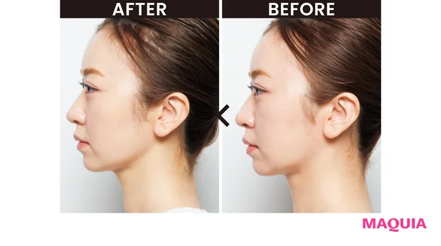 BEFORE/AFTER 5
