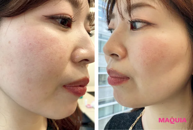 マキア 毛穴ケア おすすめ 乾燥肌 赤み 肌状態