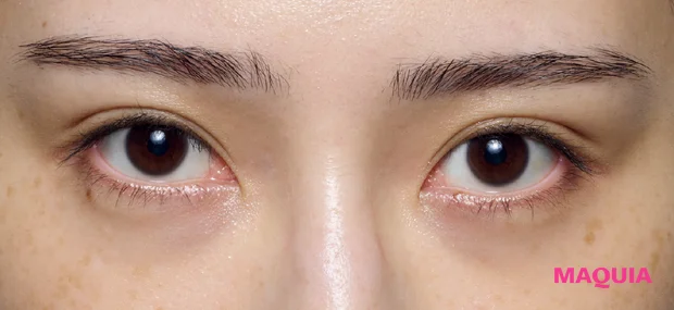 紫ぐまタイプのくまカバー＆涙袋メイクのテクニック ビフォー