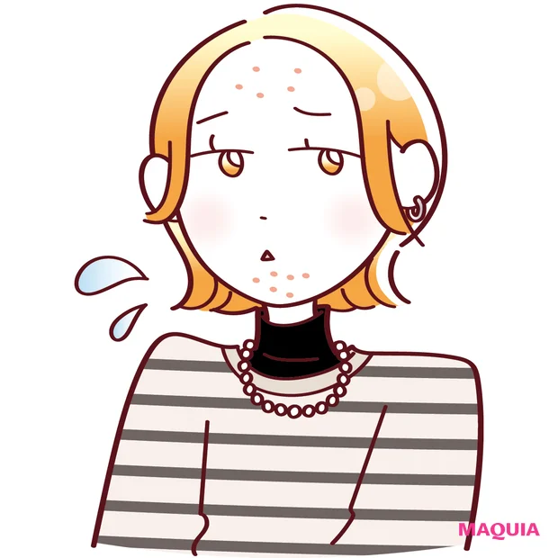 皮脂多めで毛穴が詰まりやすい「ニキビゆらぎ肌」