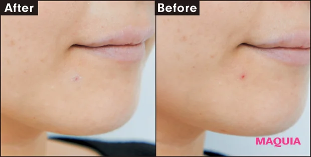 Before After