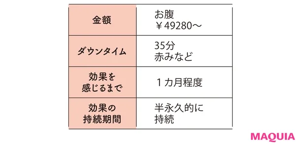 クールスカルプティングの金額やダウンタイム