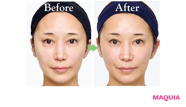 2026年春夏新作 おすすめブライトニングスキンケア SK-II ジェノプティクス アドバンスド スポット エッセンス ビフォーアフター