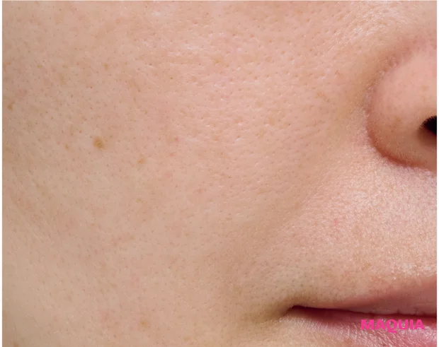 エイジングによる「たるみ毛穴」は、マッサージ&最新コスメでお手入れを。話題の「ジュベルック」体験記も_7_1