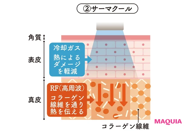 サーマクールの特徴