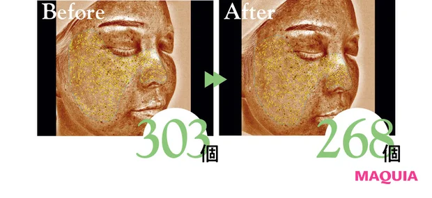 2026年春夏新作 おすすめブライトニングスキンケア FAS ザ ブラック ブライトセラム Ⅱ 表面下シミの個数 ビフォーアフター