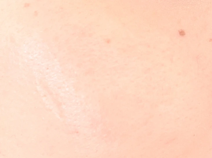 ディセンシア新作！ 人気のシワ改善オイル状美容液から、BBエッセンス誕生_5_1