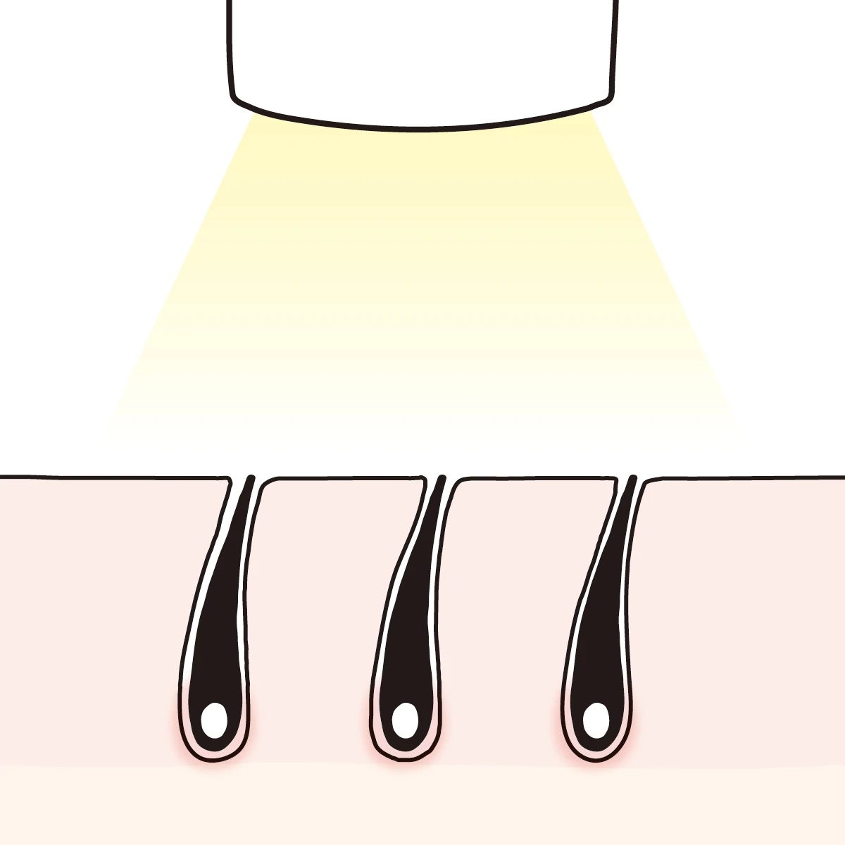 カミソリなどでムダ毛を処理