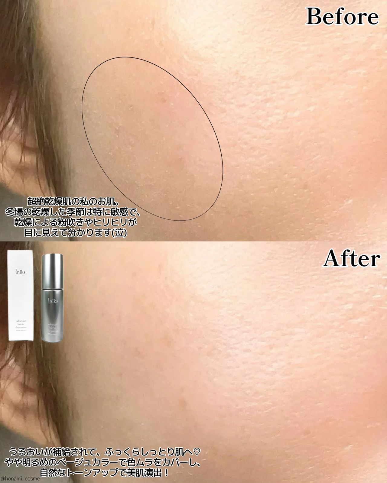【敏感肌さん必見】日中隙なし!🌞iniks(イニクス)から日焼け止め×化粧下地×美容液の3way時短アイテムが新登場!【エイジングケア】_7