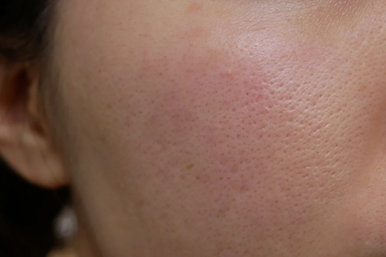 イニクス アドバンスバリア デイエッセンス