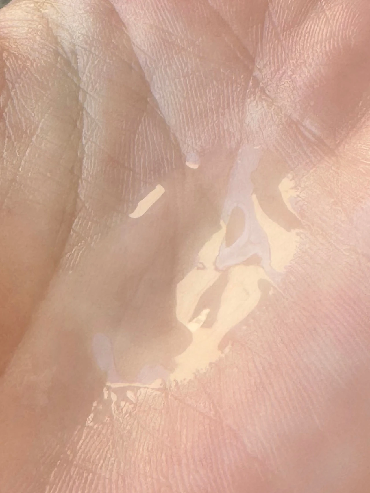 オーディナリー　ナイアシンアミド　美容液　亜鉛